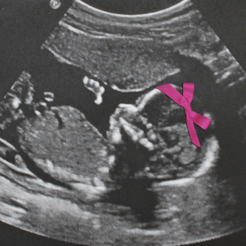ultrassom gravidez