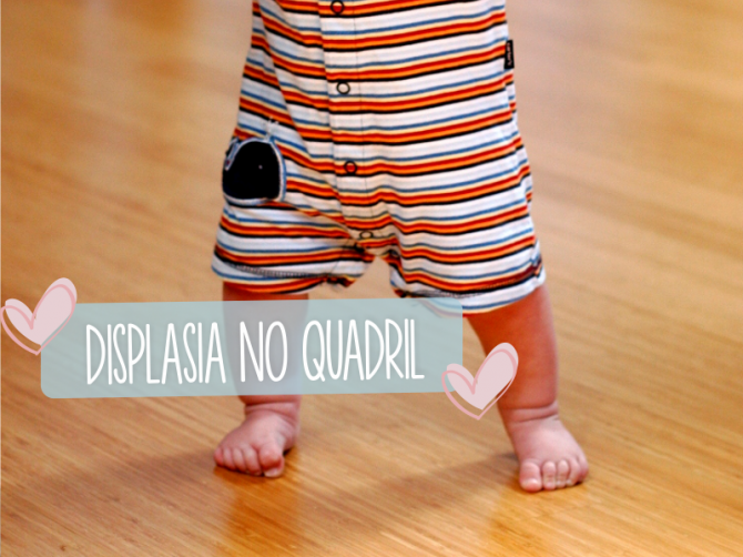 displasia no quadril