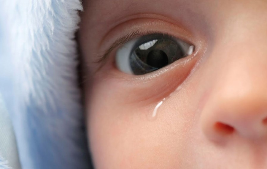 Olhinho do bebê lacrimejando