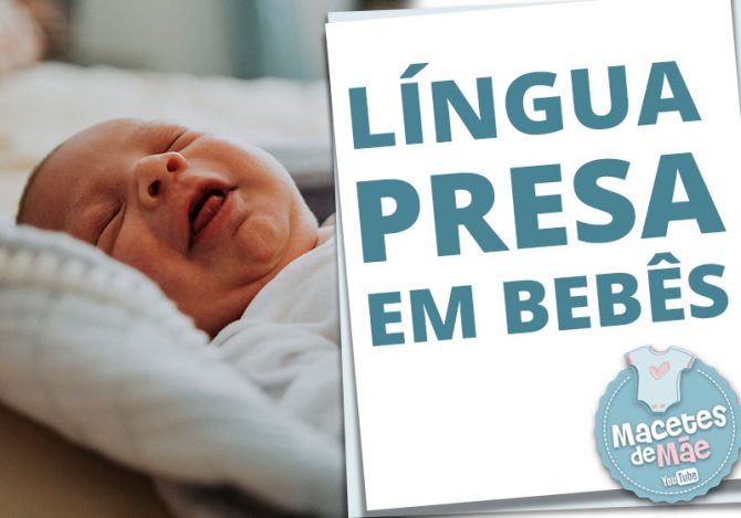 língua presa em bebês
