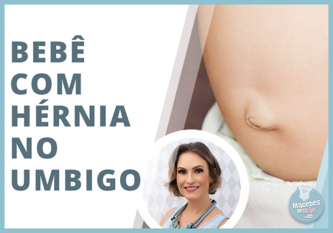 Hérnia umbilical em bebês
