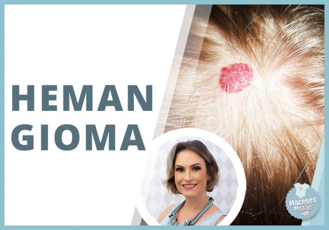 hemangioma infantil