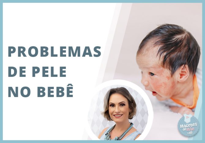 Problemas de pele mais comuns no recém-nascido