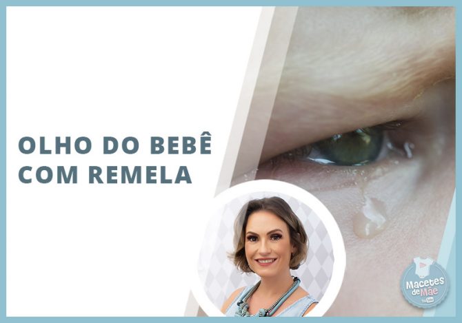 remela no olho do bebê