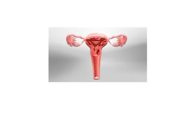 adenomiose