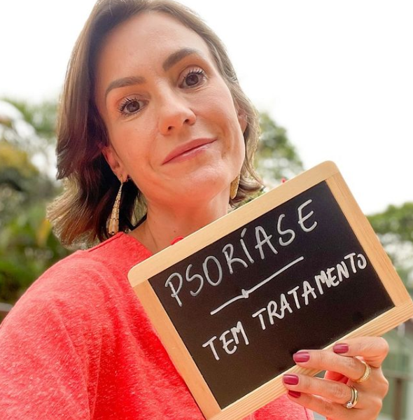 Psoríase